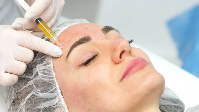 Understanding PRP Therapy and Its Applications in Aesthetics