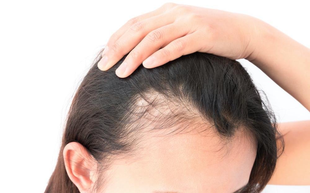 Is Hair Replacement or Hair Growth Right for Me Is Hair Replacement or Hair Growth Right for Me?