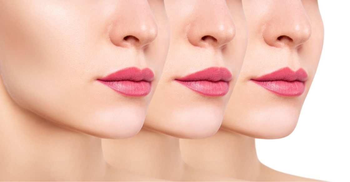 The Different Types of Dermal Fillers