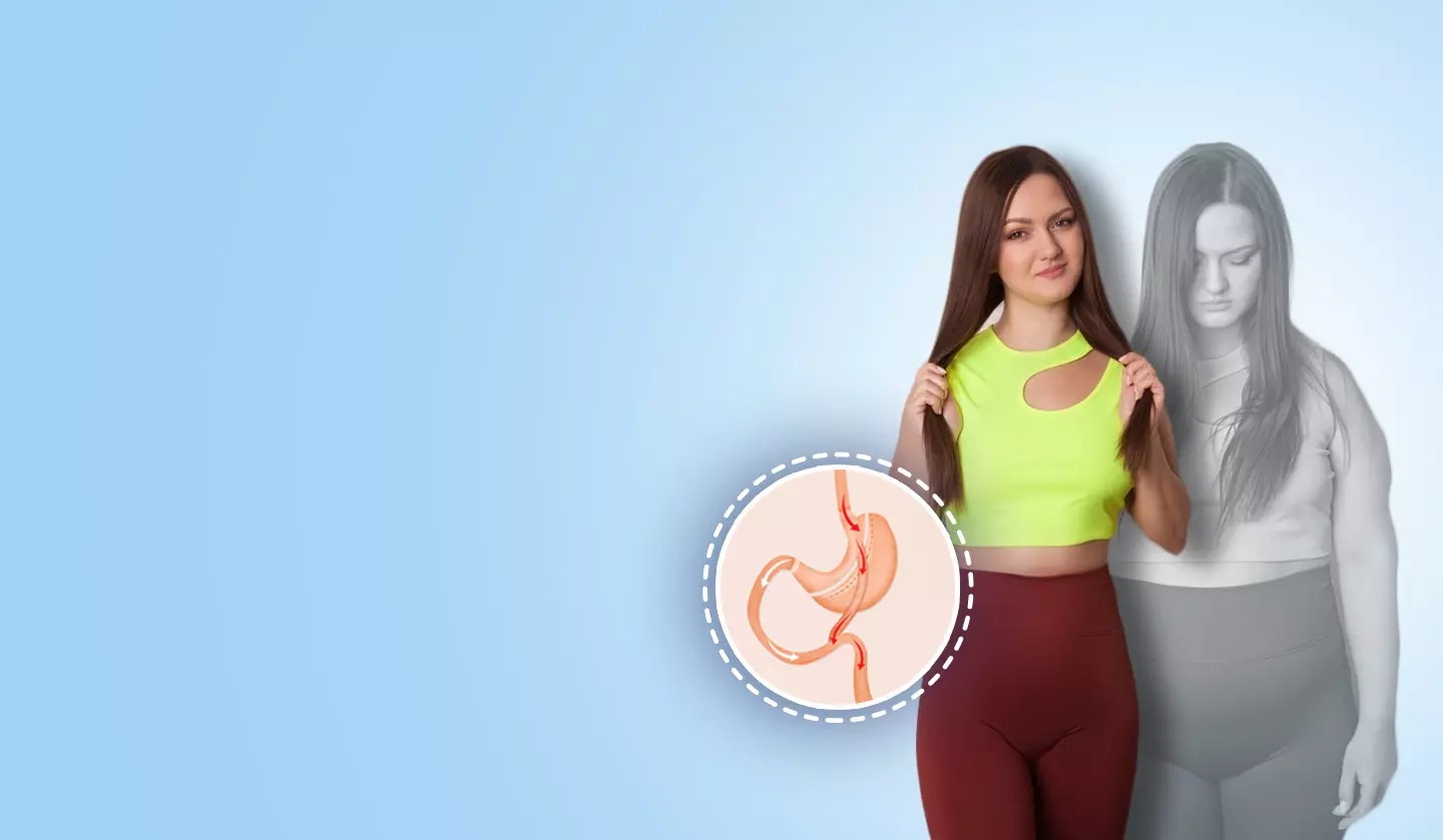Lifestyle Changes to Embrace After Hernia Repair Surgery Lifestyle Changes to Embrace After Hernia Repair Surgery