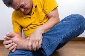 The Connection Between Gout and Other Health Conditions