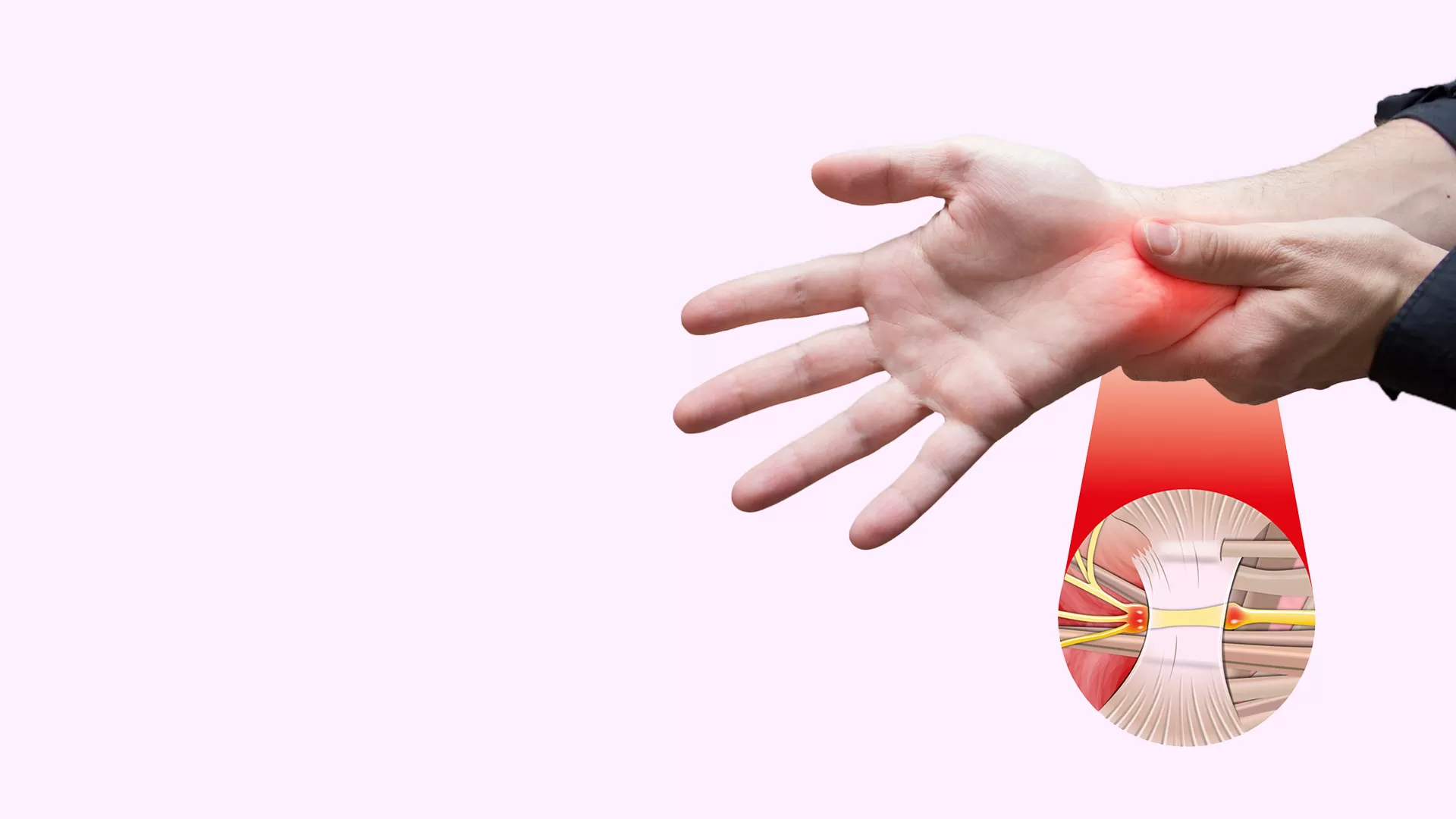 What to Know Before Undergoing Hand Surgery What to Know Before Undergoing Hand Surgery