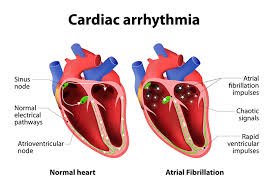 Common Heart Diseases and Their Treatments