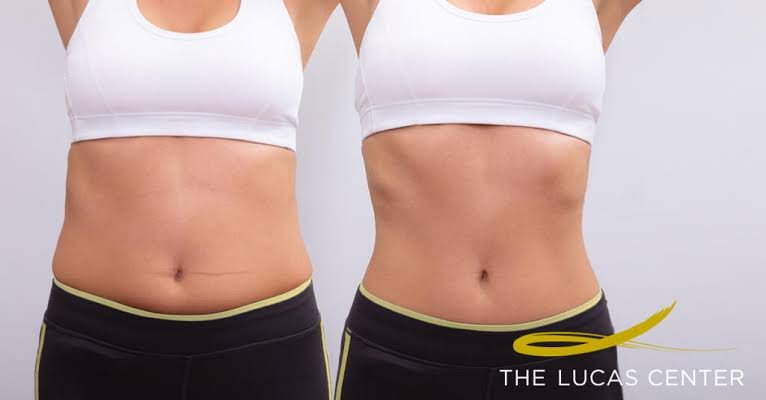 Comparing Non-surgical vs. Surgical Body Contouring Comparing Non-surgical vs. Surgical Body Contouring